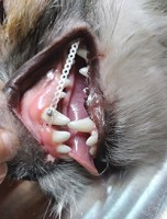 нарушение зубного ряда